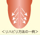 ガーゼ