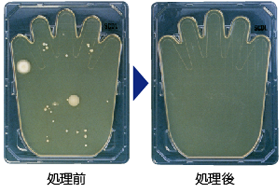 パームスタンプ法
