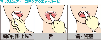 マウスピュア口腔ケアウエットガーゼ